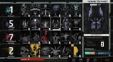 Disco Elysium - The Final Cut