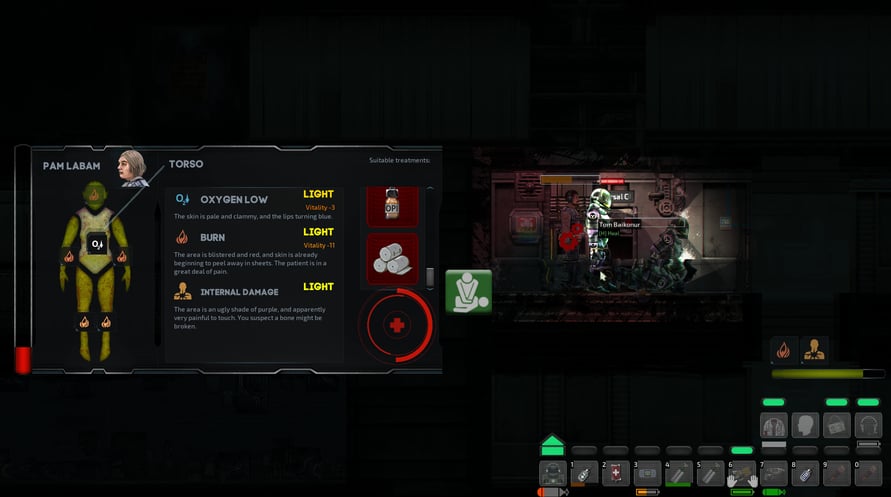 Barotrauma