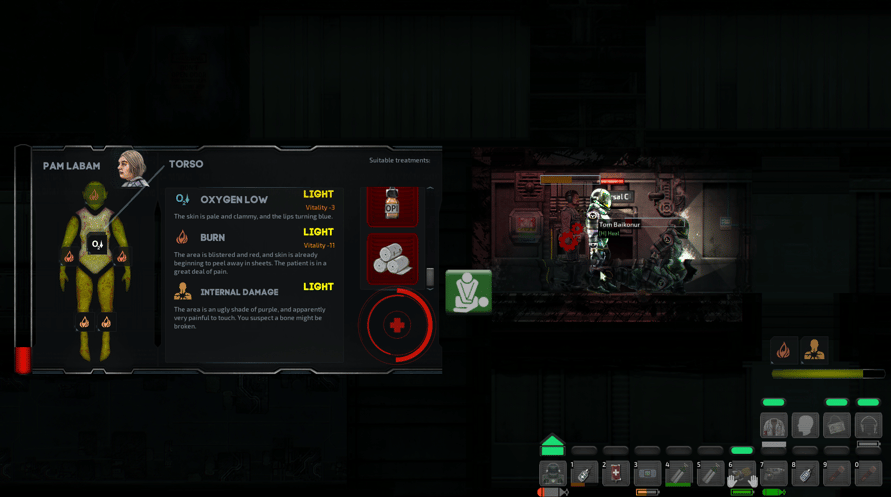 Barotrauma